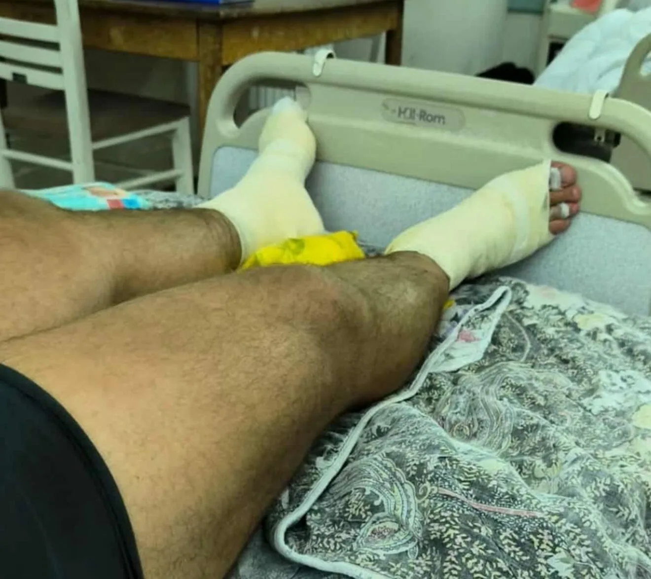 Повредени пожарникари Виница